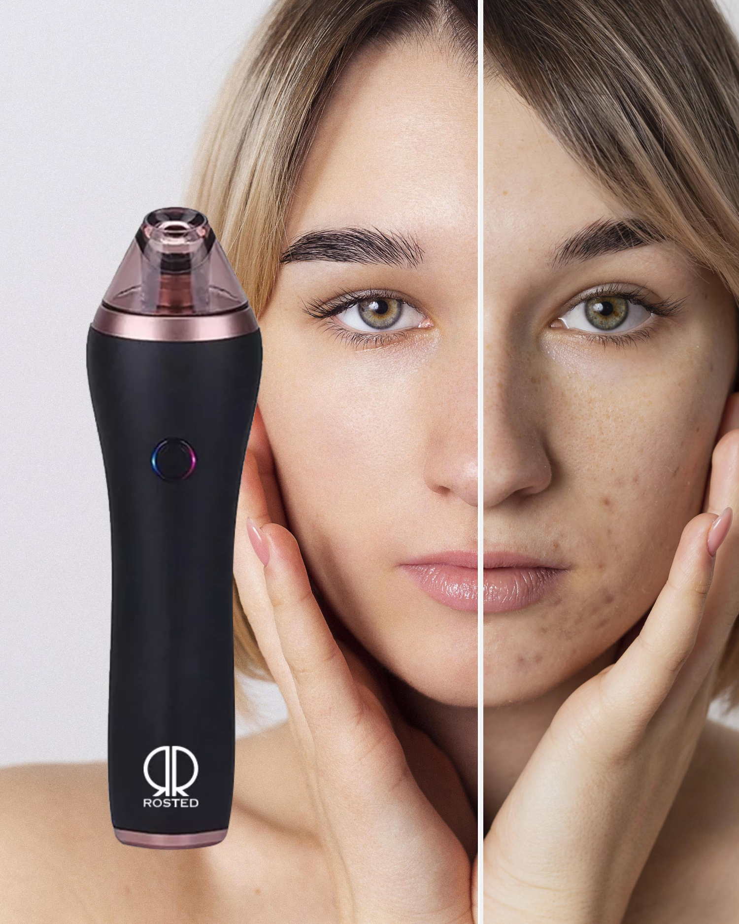 Rosted MicroDerm - Diamantabrasiv för huden